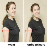 Avant et apres manchon amincissant bras
